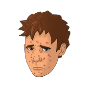 chicken pox